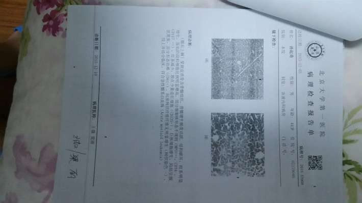 求助 一个白血病病人家属的求助