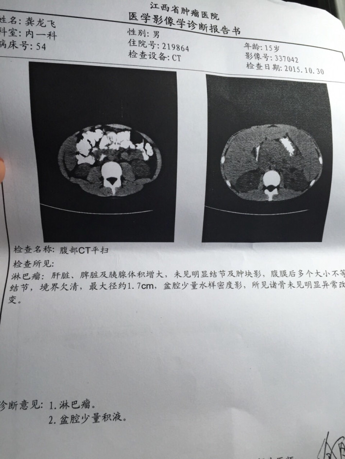 救救我的儿子--十五岁儿子身患母细胞性白血病/淋巴瘤