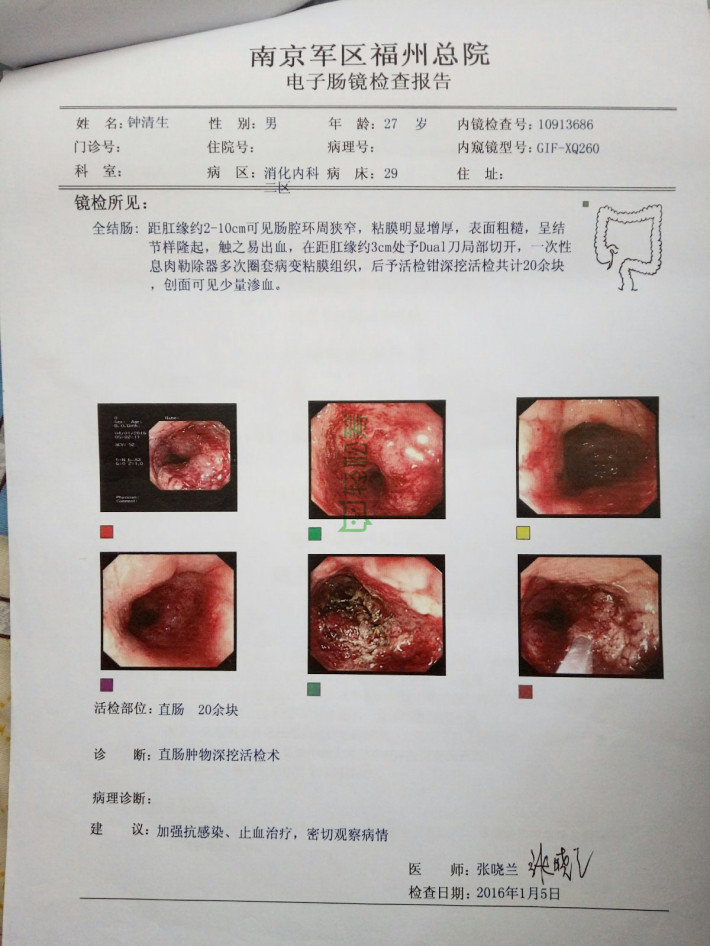 现已做完第四次化疗和20多次放射治疗,前期检查治疗已花尽家中积蓄和